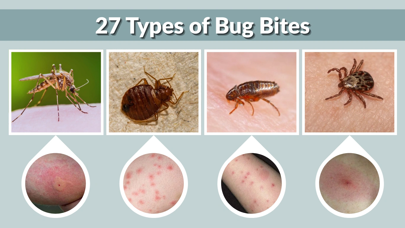 27 Types of Bug Bites Identification, Symptoms & Treatment