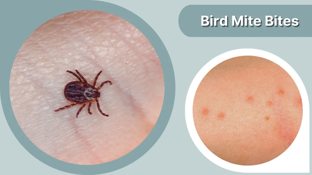 Bird Mite Bites