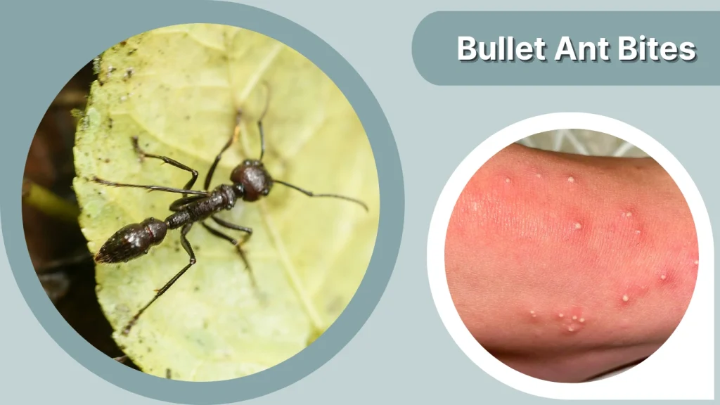 Bullet Ant Bites