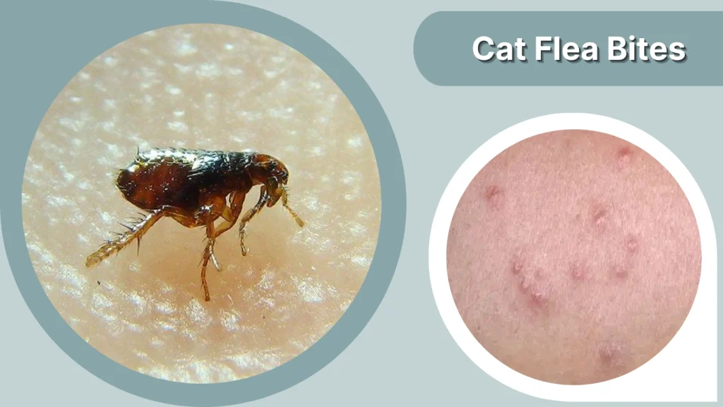 Cat Flea Bites