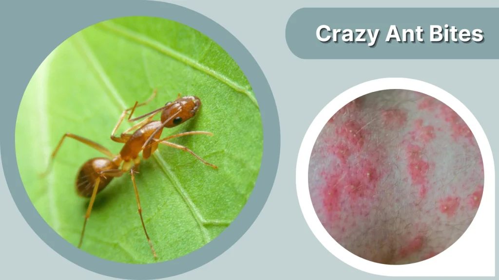 Crazy Ant Bites