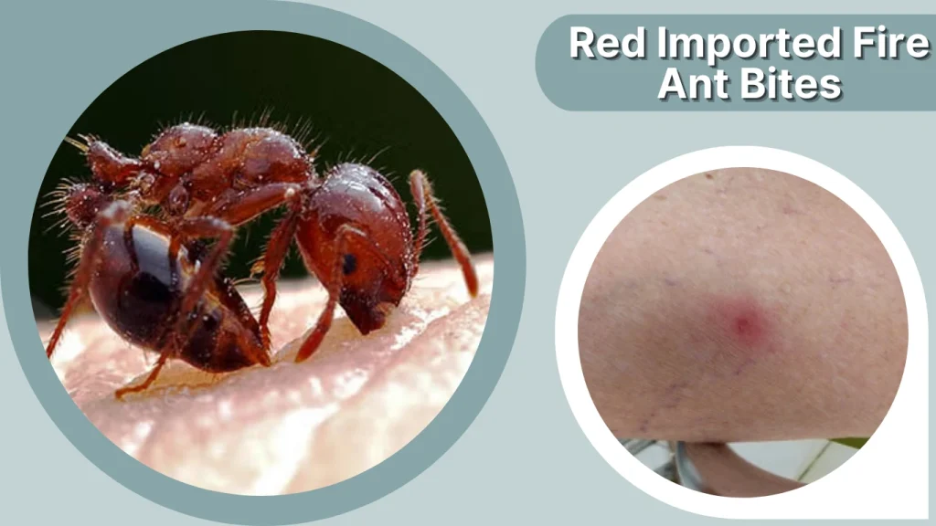 Red Imported Fire Ant Bites