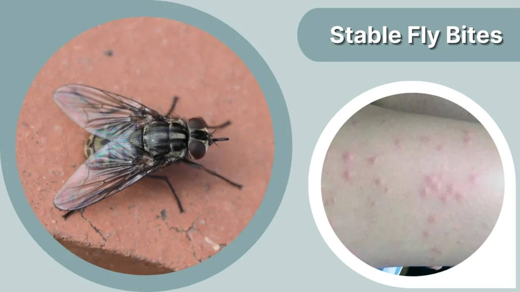 Stable Fly Bites