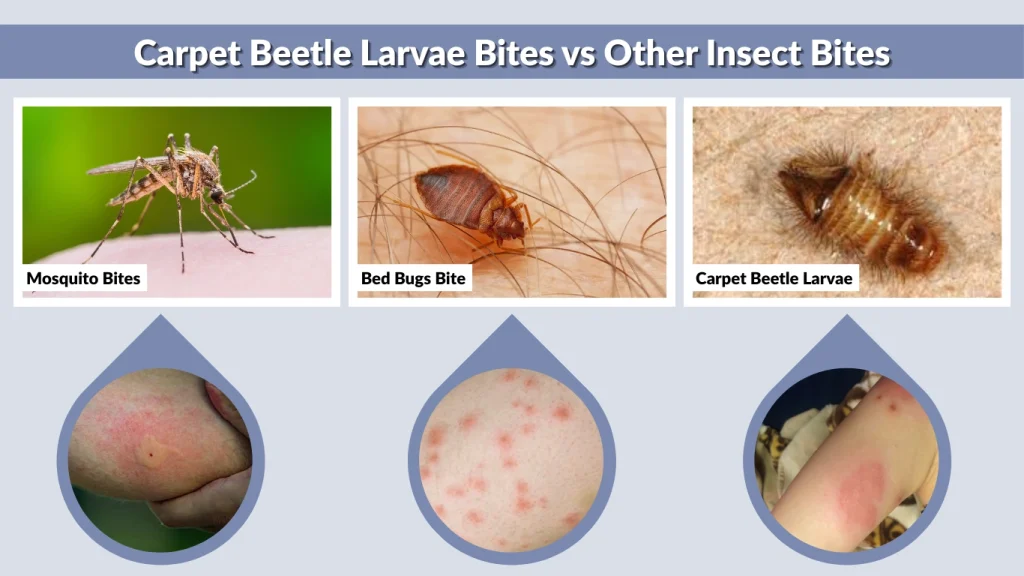 Carpet Beetle Larvae Bites vs Other Insect Bites