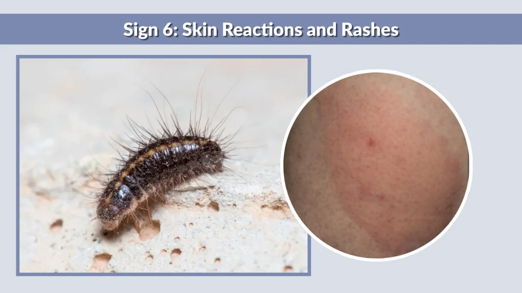 Sign 6 Skin Reactions and Rashes