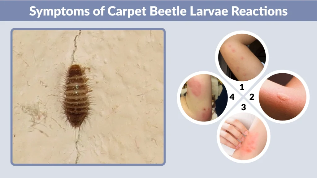 Symptoms of Carpet Beetle Larvae Reactions