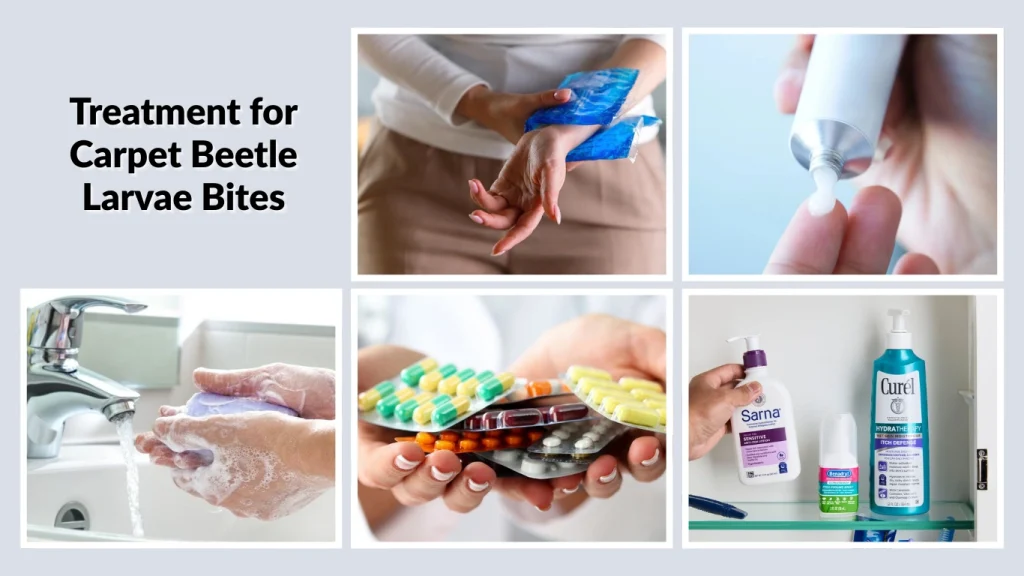 Treatment for Carpet Beetle Larvae Bites