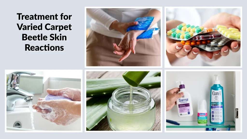 Treatment for Varied Carpet Beetle Skin Reactions