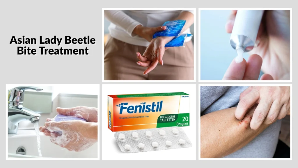 Asian Lady Beetle Bite Treatment