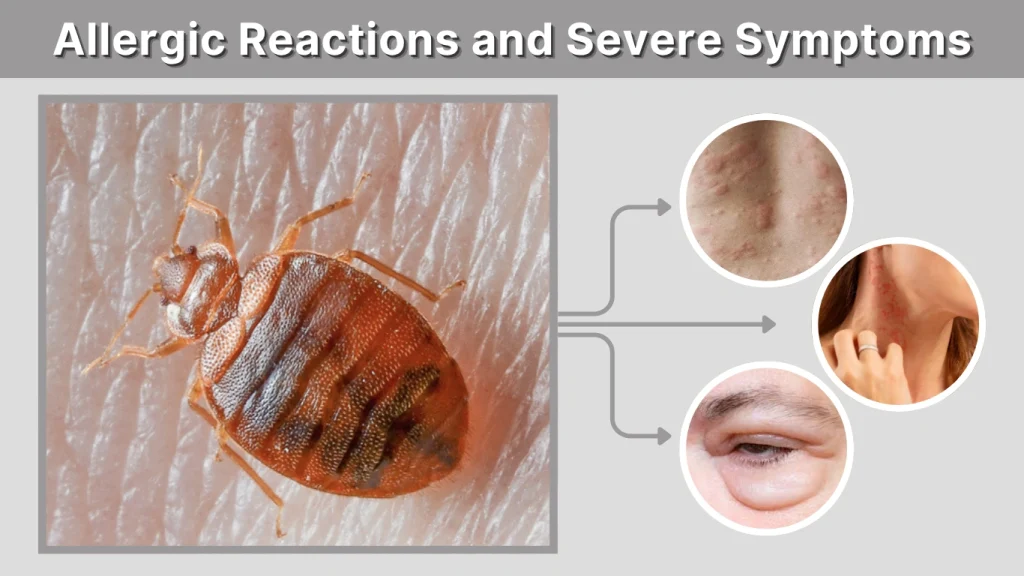 Allergic Reactions and Severe Symptoms
