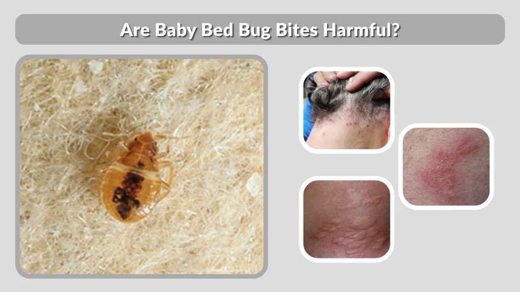 Are Baby Bed Bug Bites Harmful