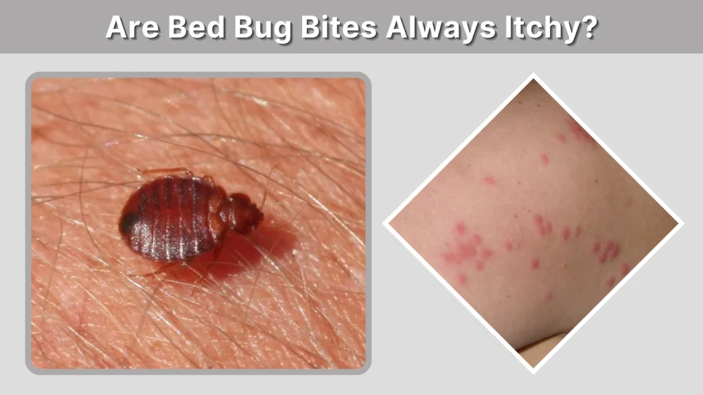Are Bed Bug Bites Always Itchy