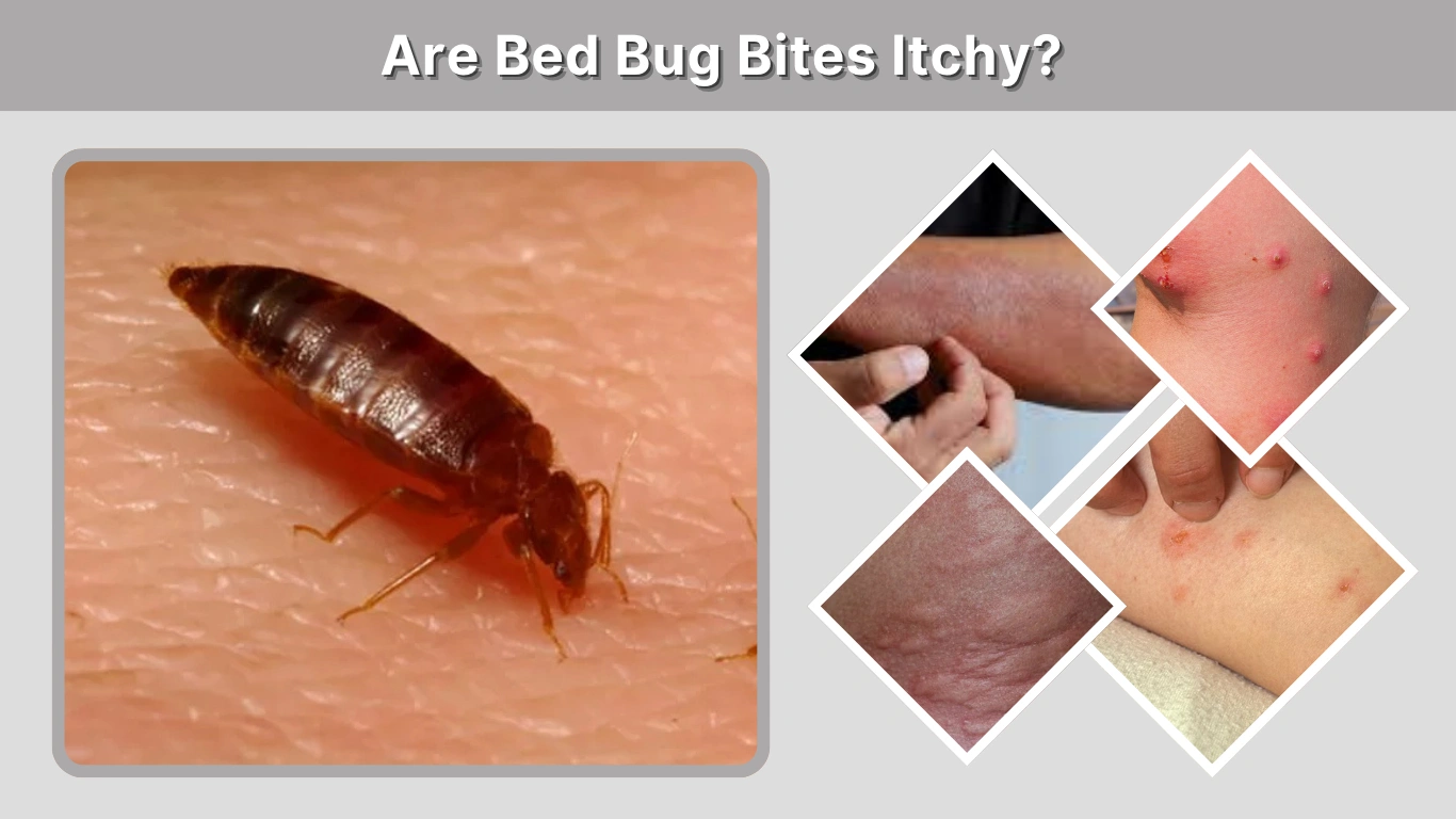 Are Bed Bug Bites Itchy Causes, Intensity & Relief Guide