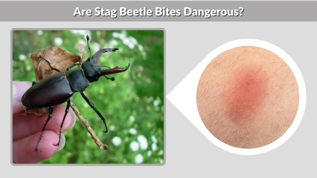 Are Stag Beetle Bites Dangerous