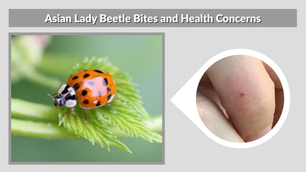 Asian Lady Beetle Bites and Health Concerns