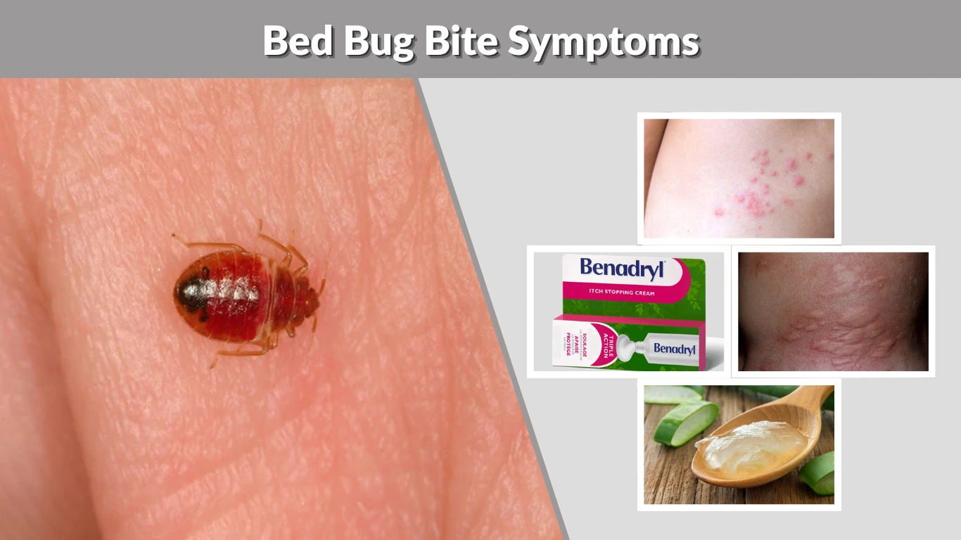 Bed Bug Bite Symptoms Identification, Timeline & Early Treatment