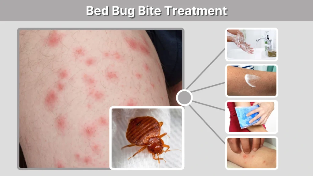 Bed Bug Bite Treatment