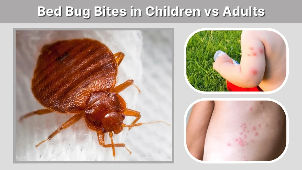 Bed Bug Bites in Children vs Adults