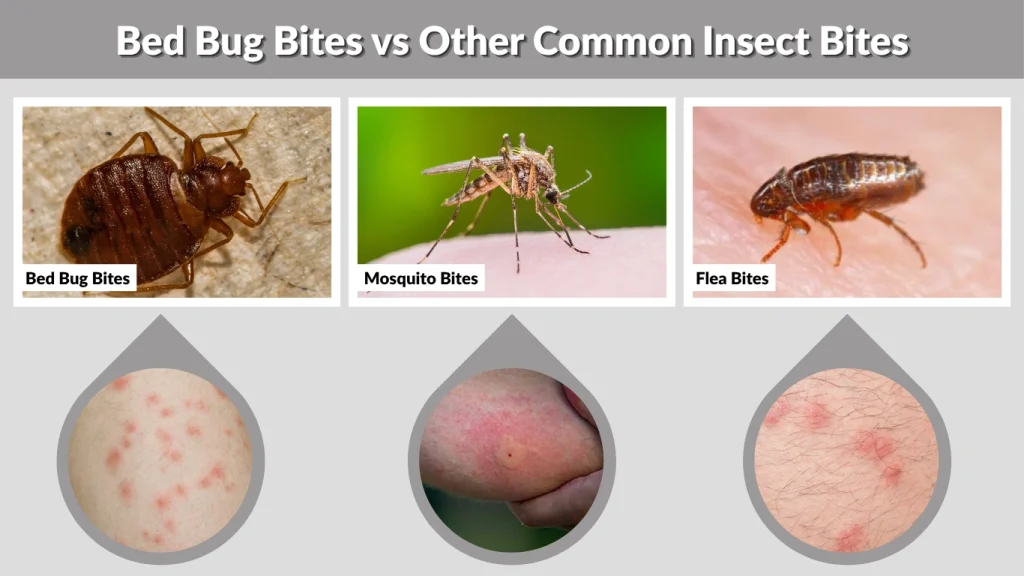 Bed Bug Bites vs Other Common Insect Bites