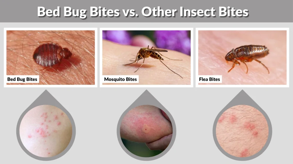 Bed Bug Bites vs. Other Insect Bites