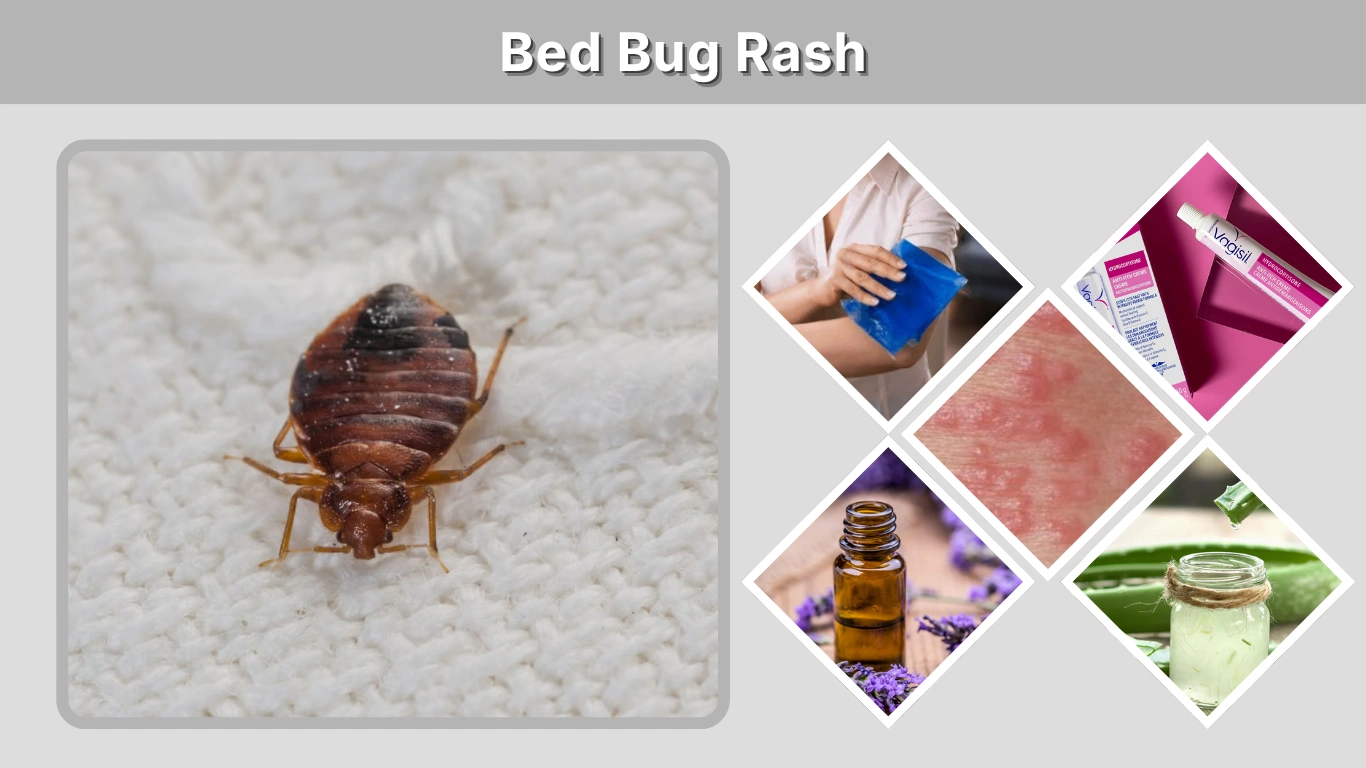 Bed Bug Rash Symptoms, Pictures, Causes, and Treatment