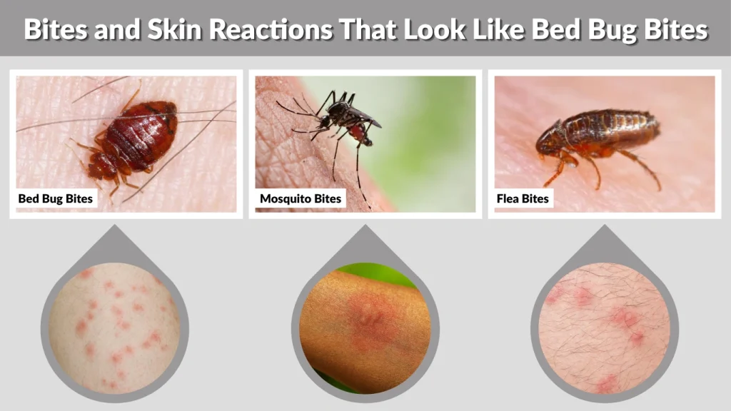 Bites and Skin Reactions That Look Like Bed Bug Bites