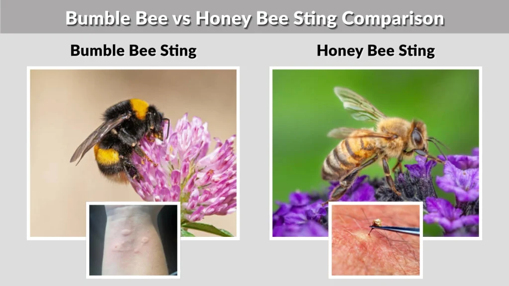 Bumble Bee vs Honey Bee Sting Comparison