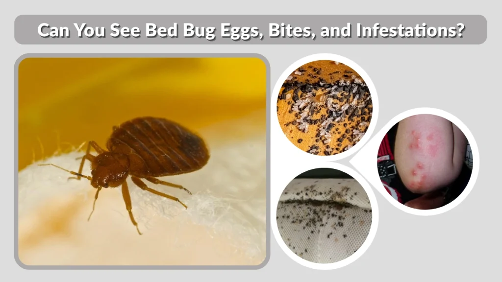 Can You See Bed Bug Eggs, Bites, and Infestations