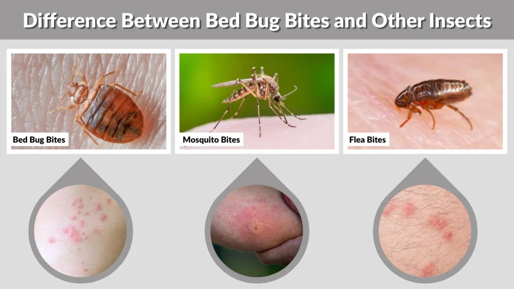 Difference Between Bed Bug Bites and Other Insects