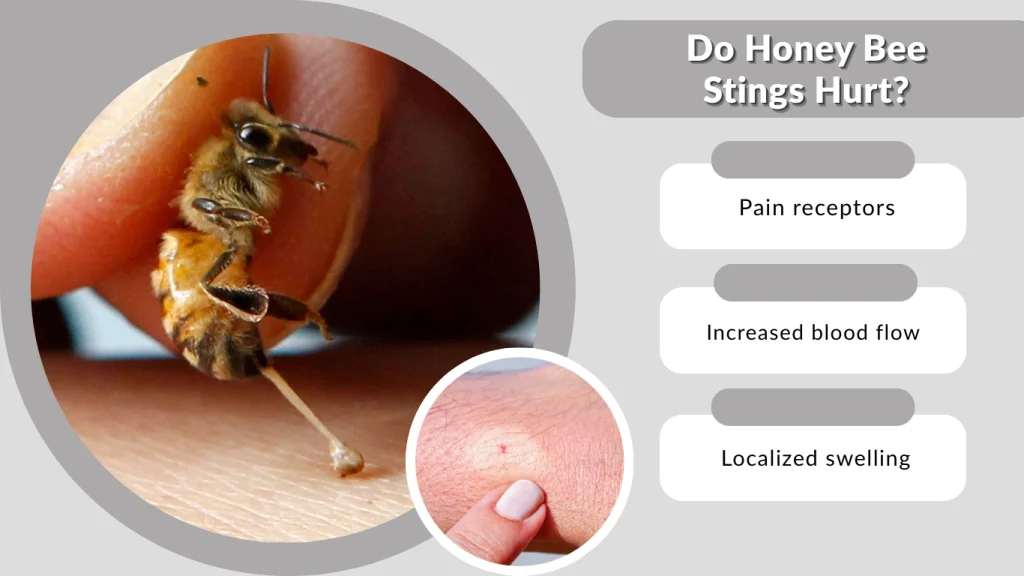 Do Honey Bee Stings Hurt
