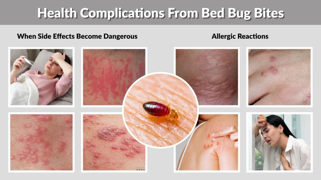 Health Complications From Bed Bug Bites