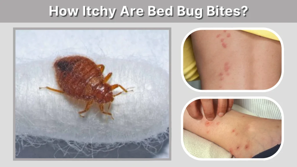 How Itchy Are Bed Bug Bites
