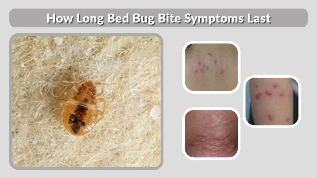 How Long Bed Bug Bite Symptoms Last