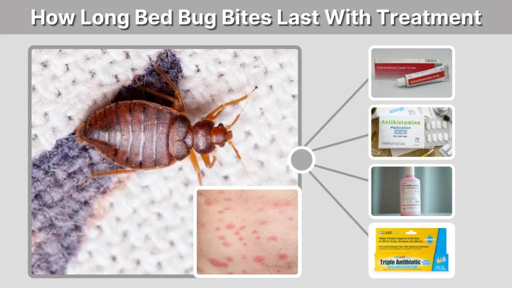 How Long Bed Bug Bites Last With Treatment