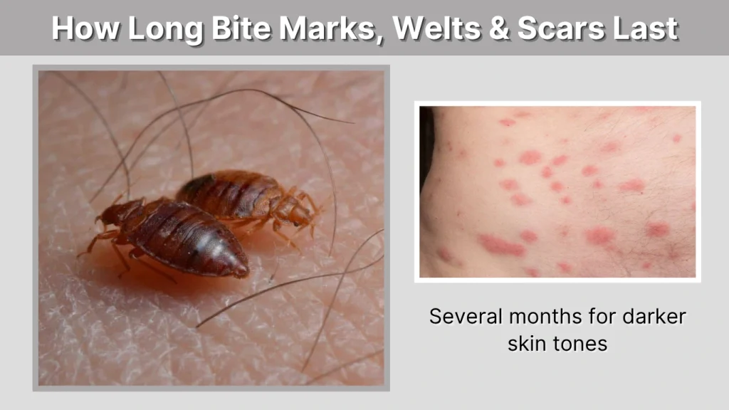 How Long Bite Marks, Welts & Scars Last