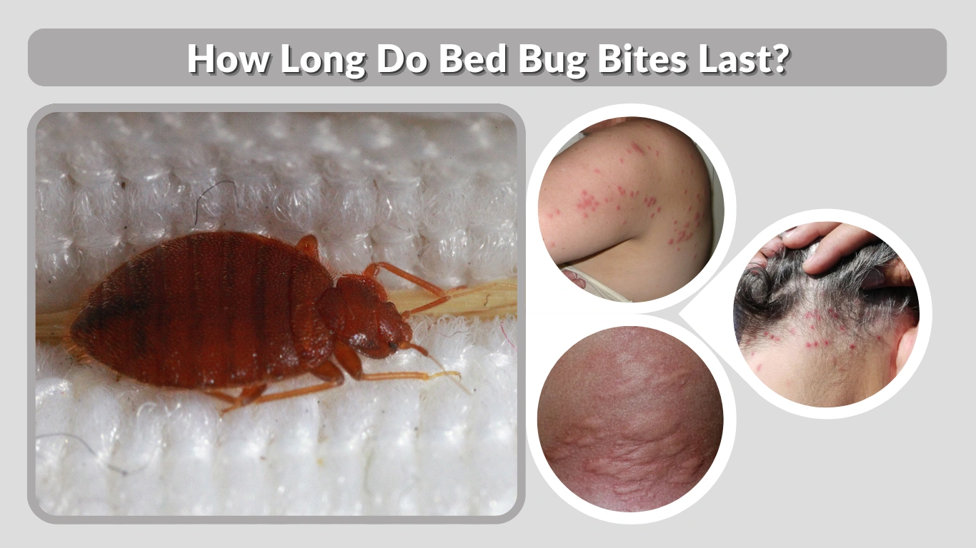 How Long Do Bed Bug Bites Last Understanding Duration