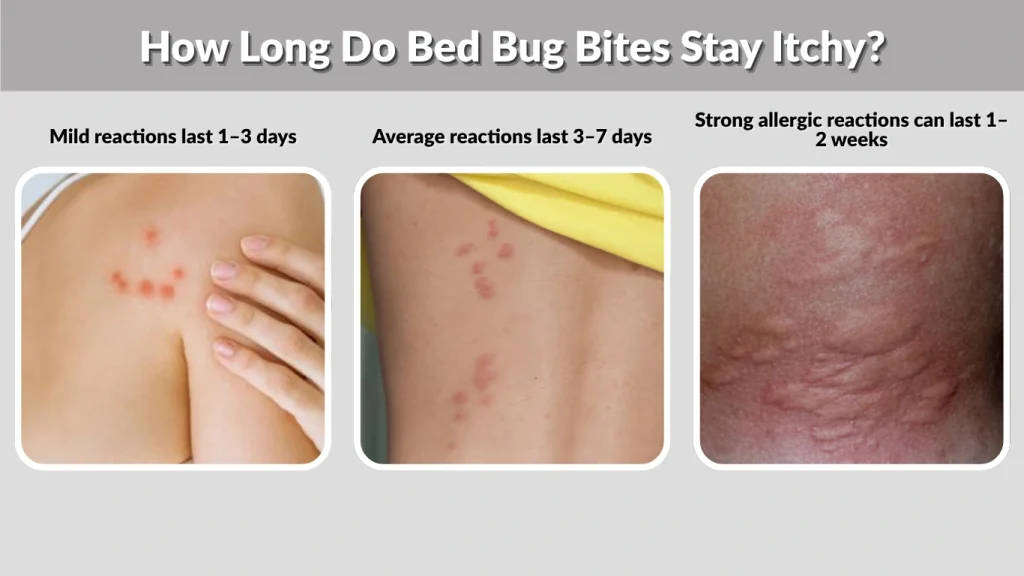 How Long Do Bed Bug Bites Stay Itchy