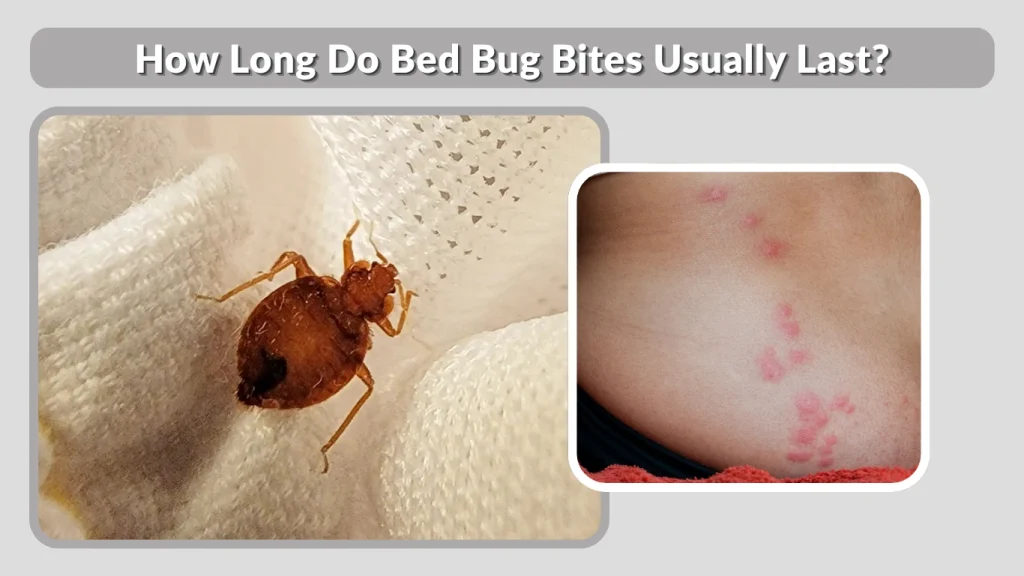 How Long Do Bed Bug Bites Usually Last