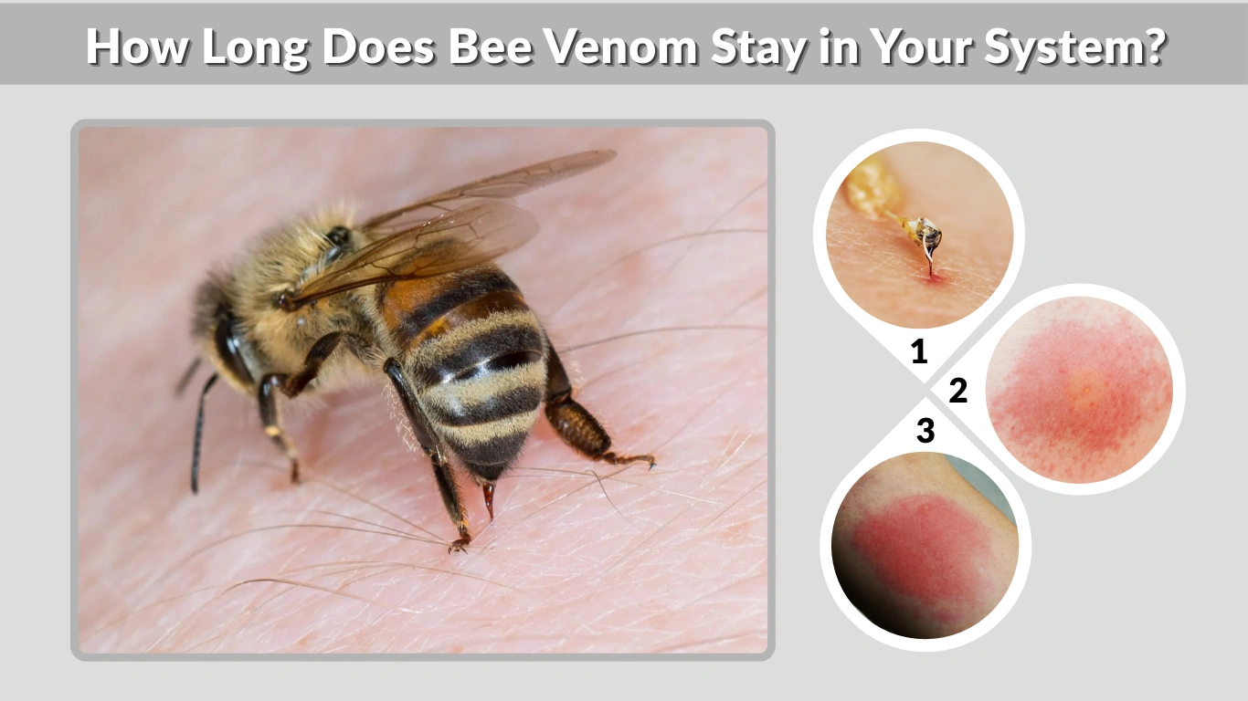 How Long Does Bee Venom Stay in Your System Full Guide