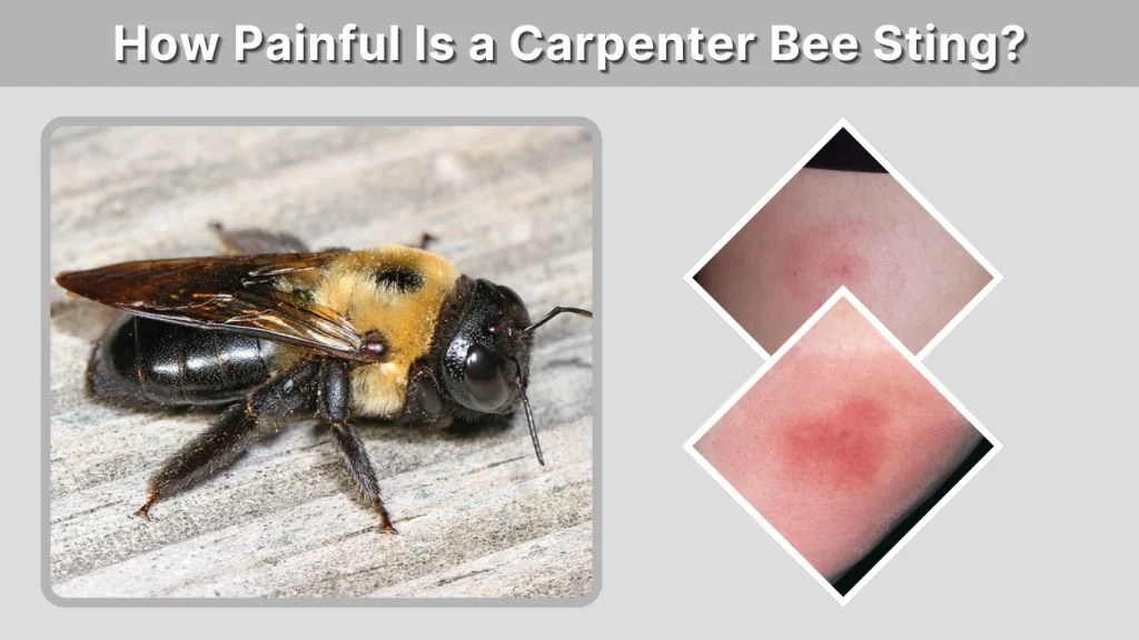 How Painful Is a Carpenter Bee Sting