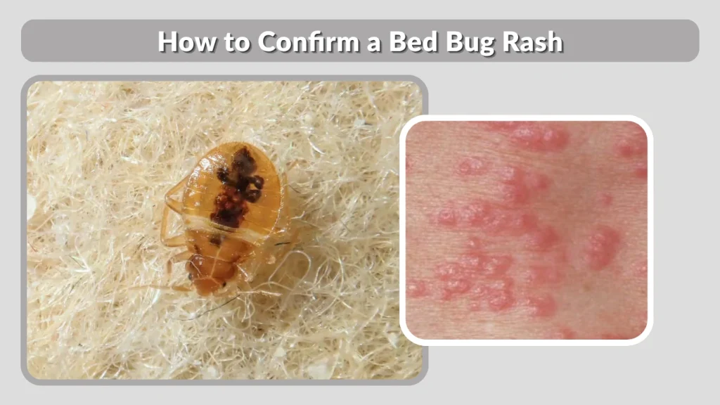 How to Confirm a Bed Bug Rash