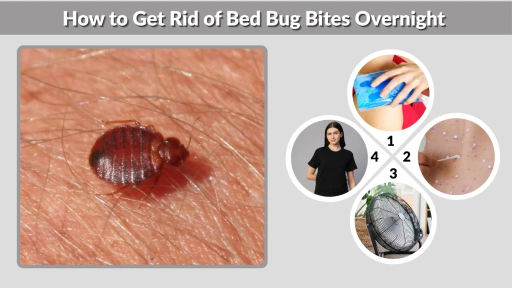 How to Get Rid of Bed Bug Bites Overnight