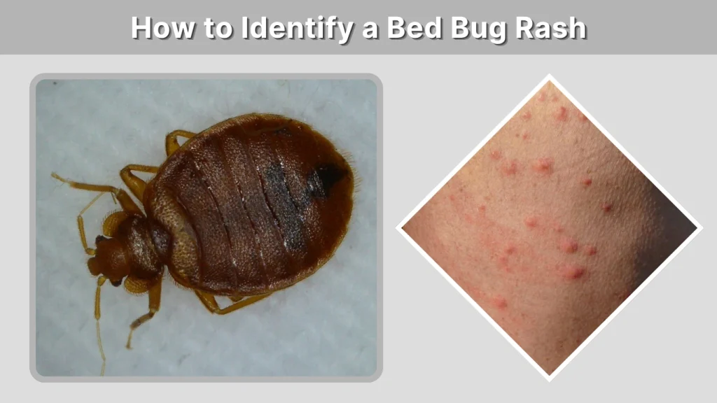 How to Identify a Bed Bug Rash