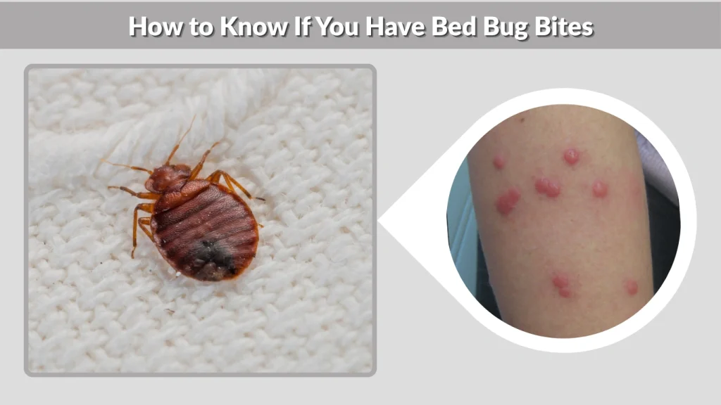 How to Know If You Have Bed Bug Bites