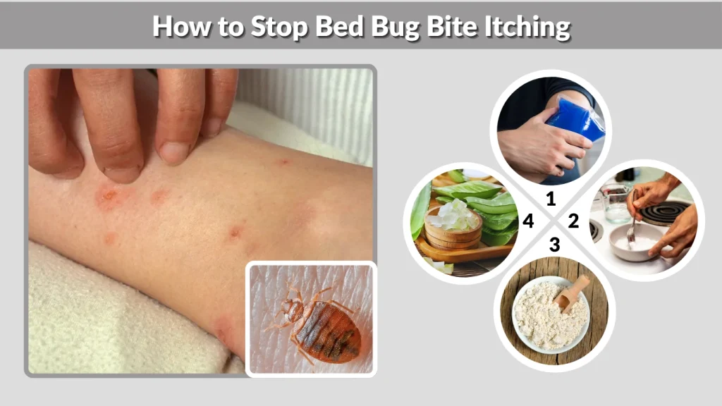 How to Stop Bed Bug Bite Itching