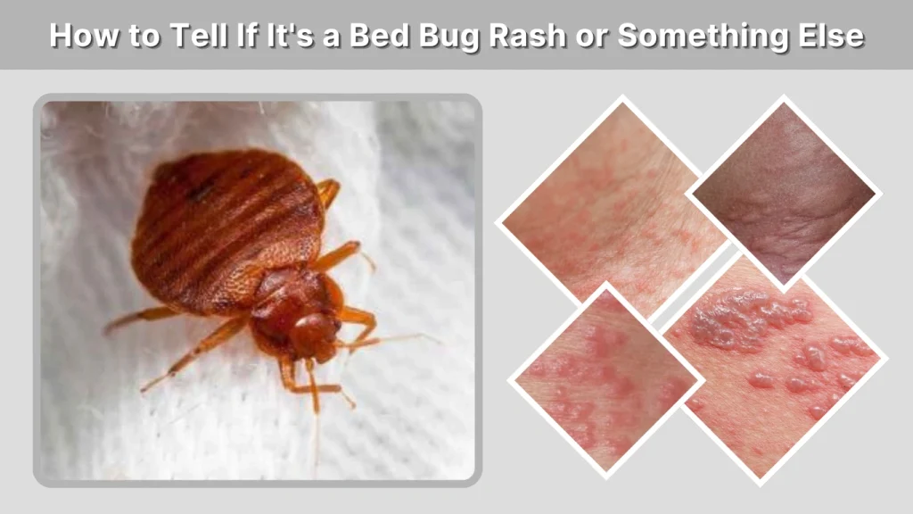 How to Tell If It's a Bed Bug Rash or Something Else