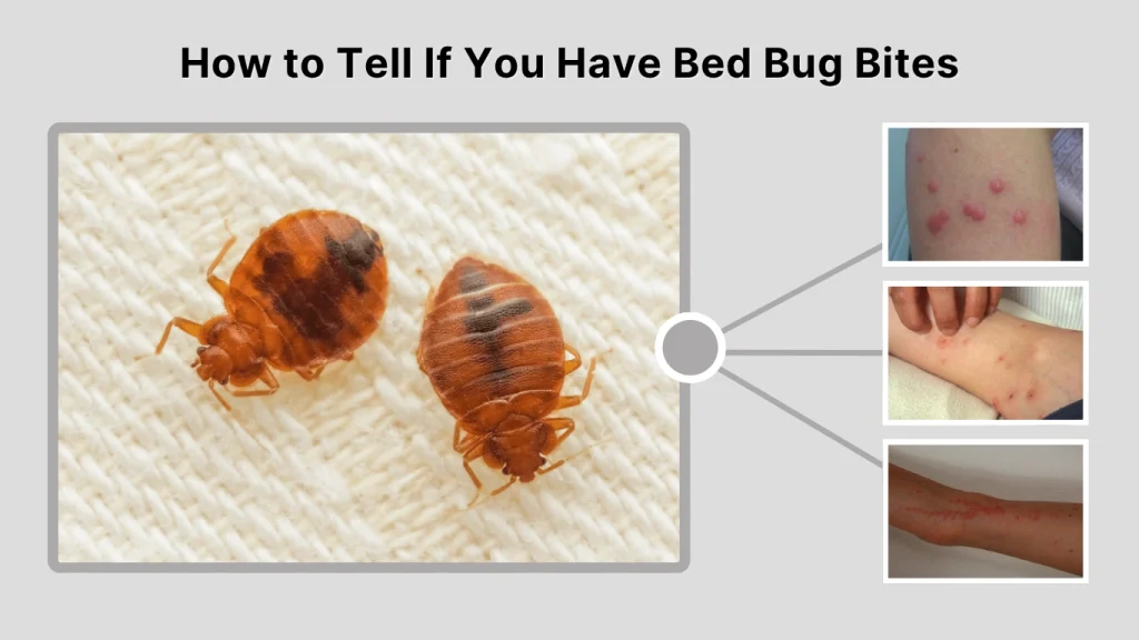 How to Tell If You Have Bed Bug Bites