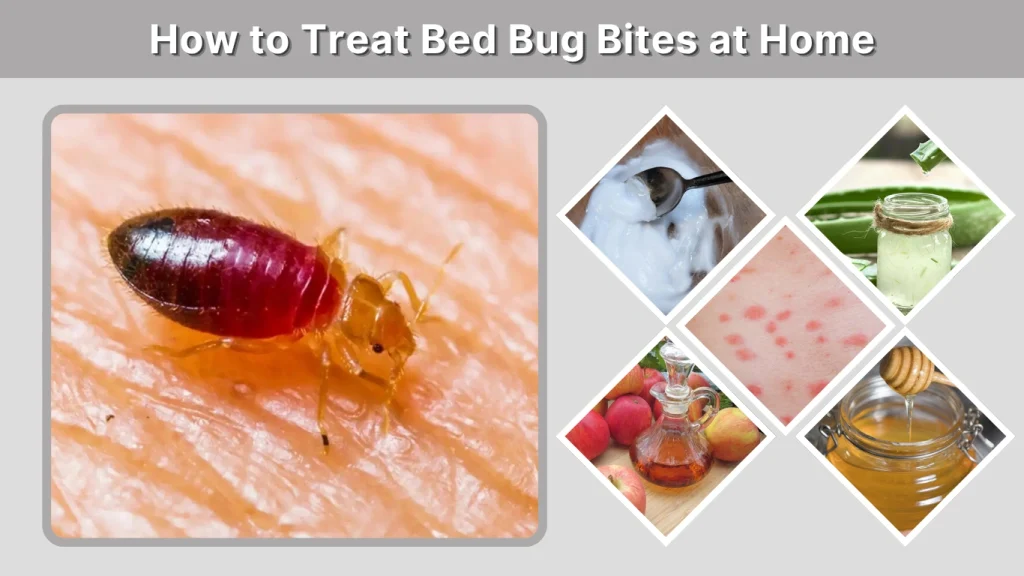 How to Treat Bed Bug Bites at Home