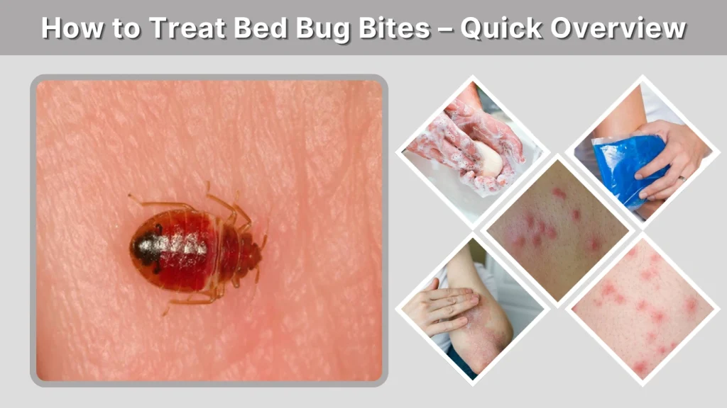 How to Treat Bed Bug Bites – Quick Overview