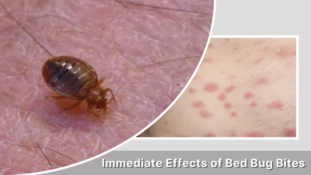 Immediate Effects of Bed Bug Bites